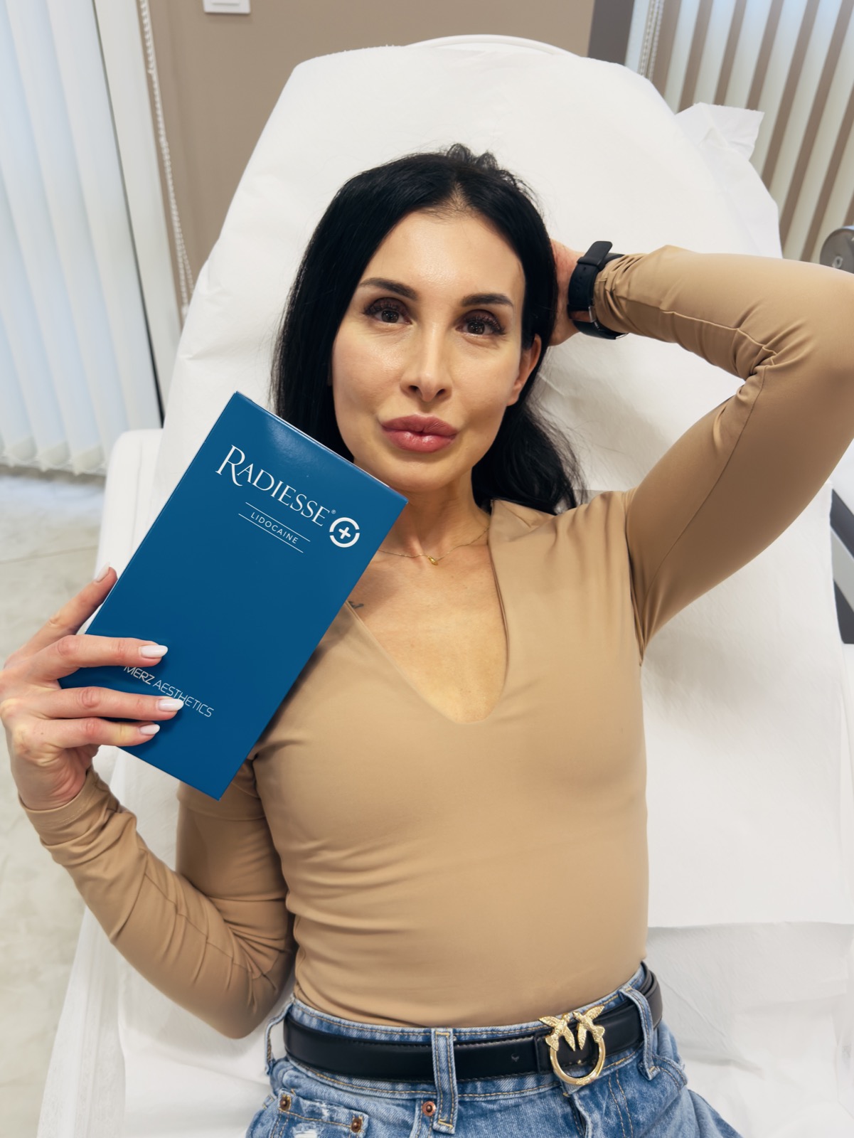 Клиентка на Vitalaiz с Radiesse® (+) Lidocaine